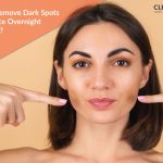 how to remove dark spots on face fast naturally