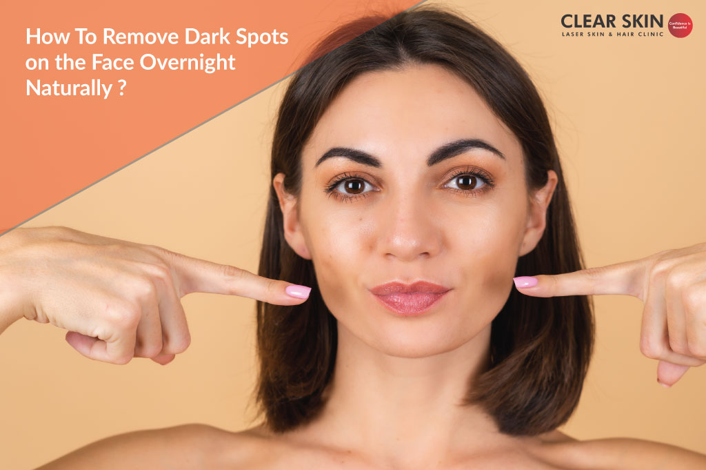 how to remove dark spots on face fast naturally